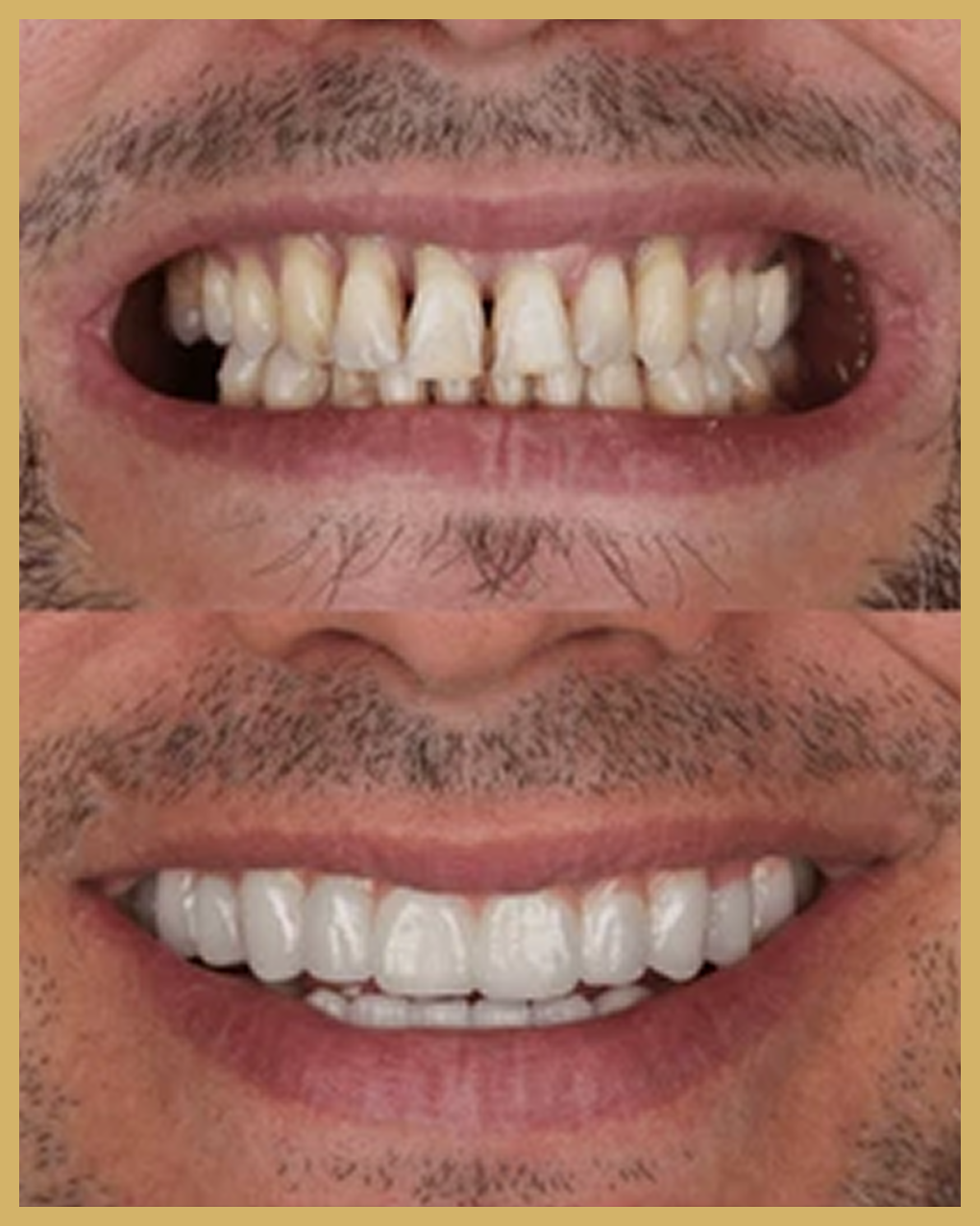 Before and after result